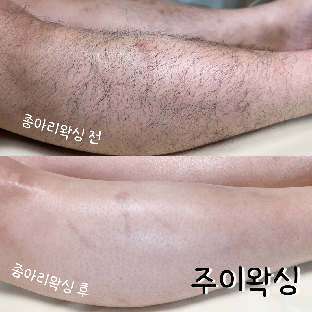 캠페인 썸네일