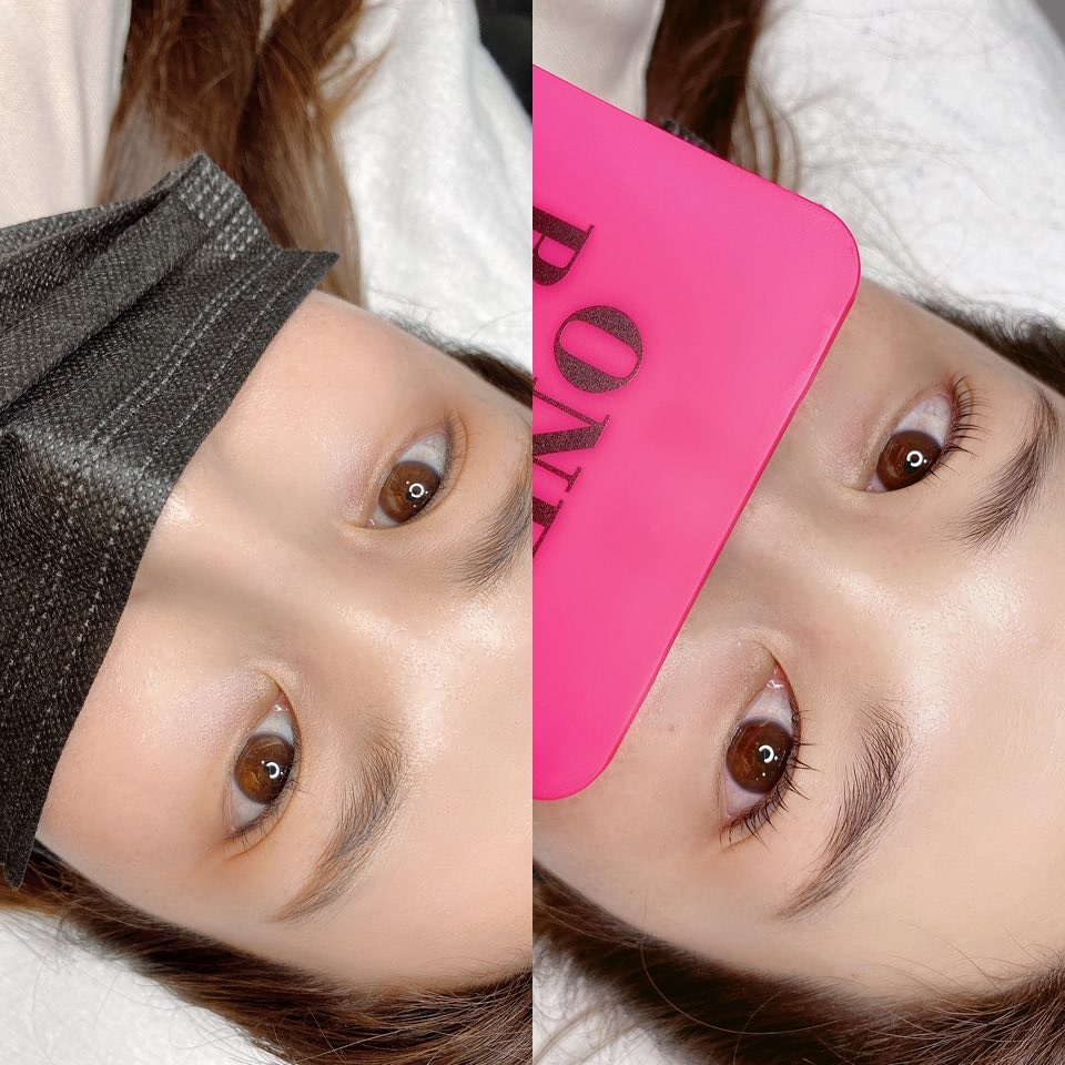 캠페인 썸네일