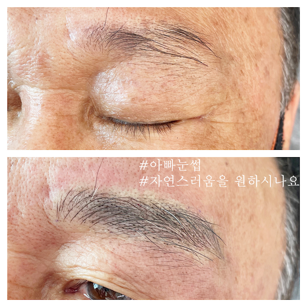 캠페인 썸네일