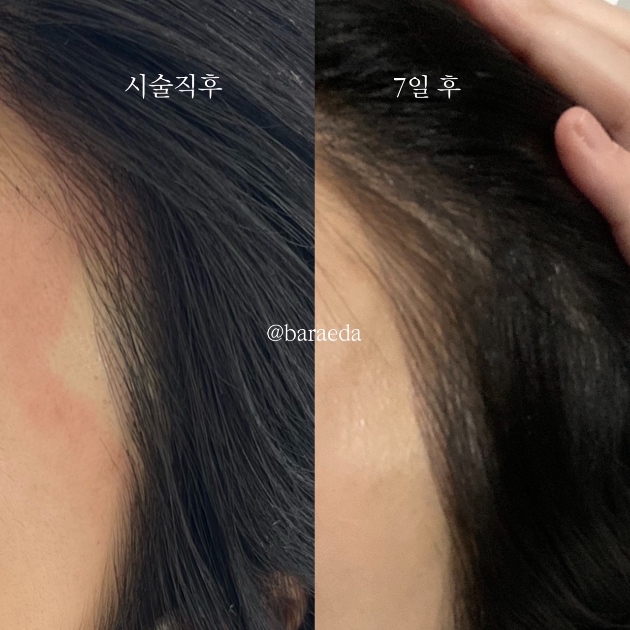캠페인 썸네일
