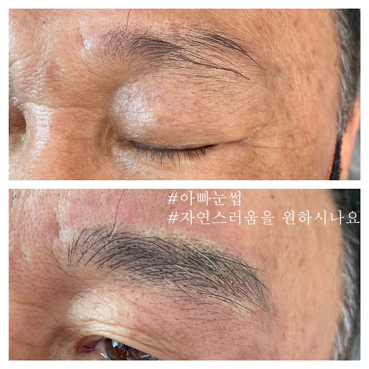 캠페인 썸네일