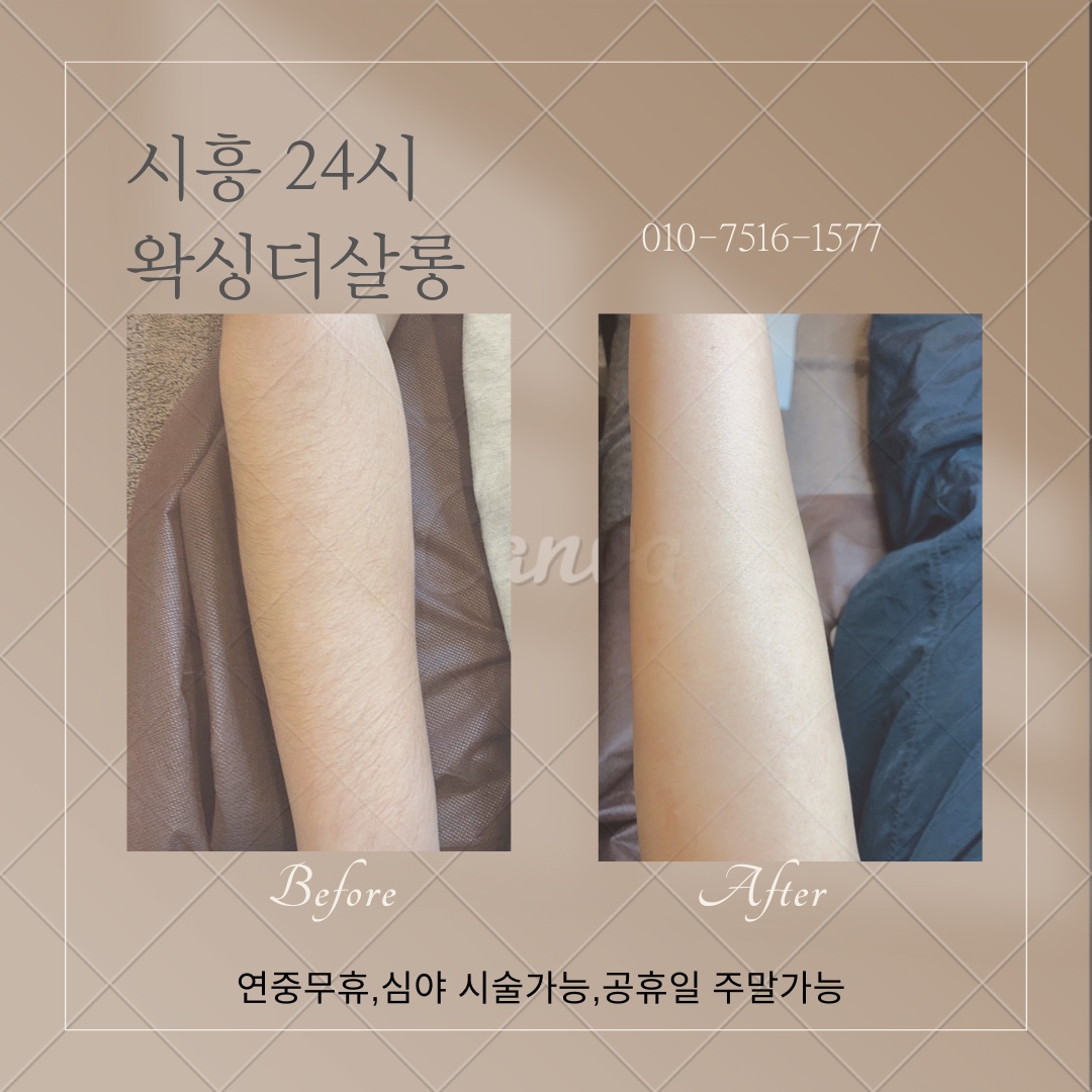 캠페인 썸네일