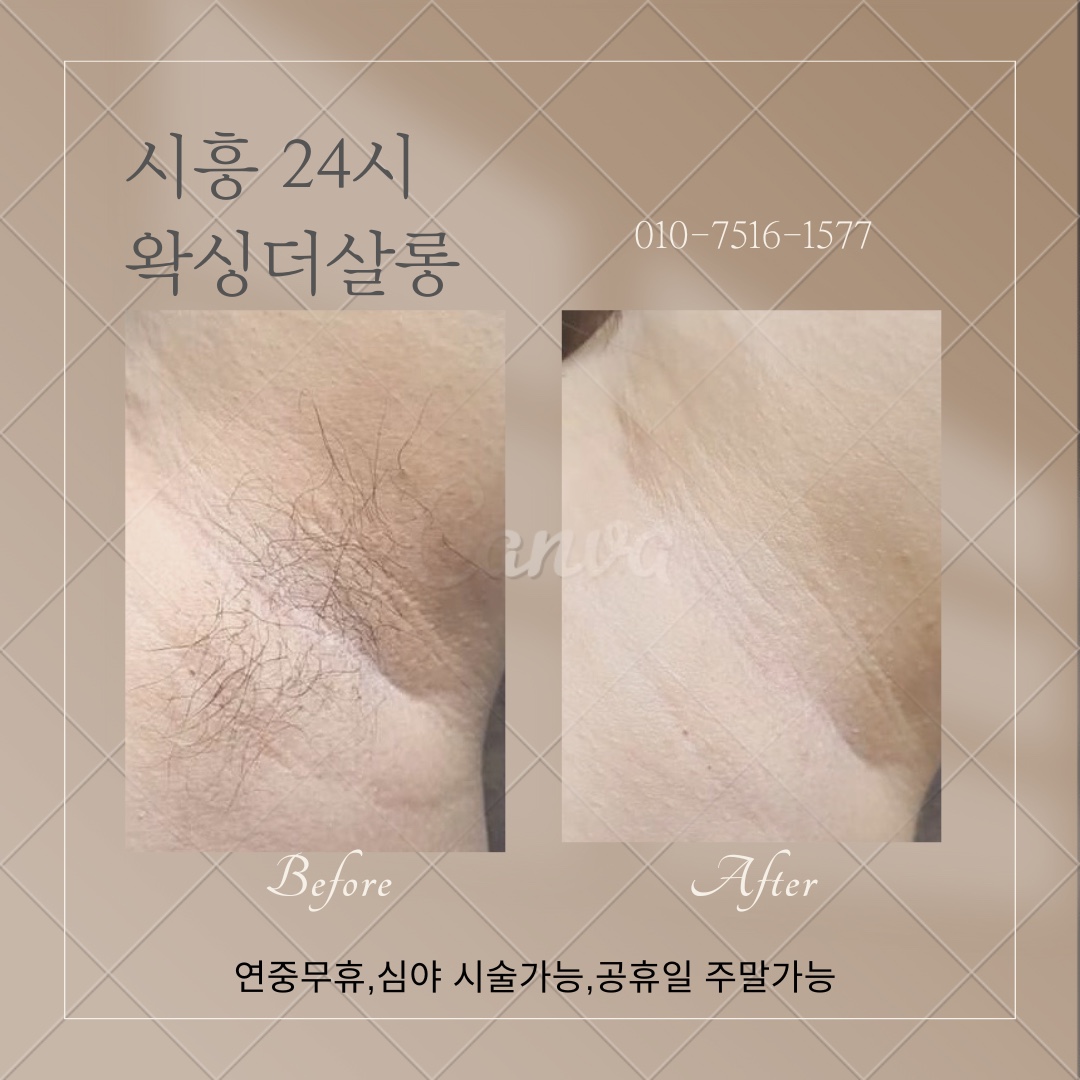 캠페인 썸네일