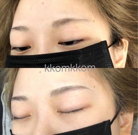 캠페인 썸네일