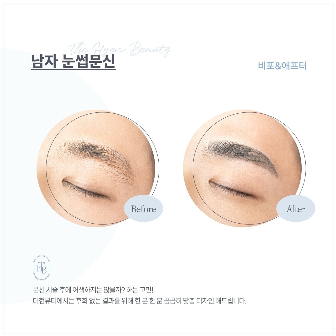캠페인 썸네일