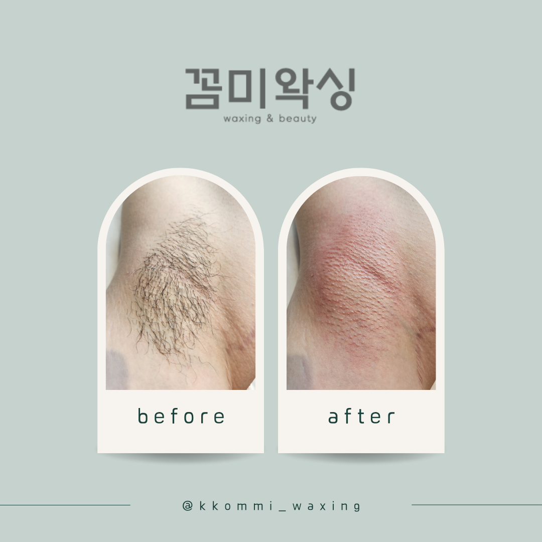 캠페인 썸네일
