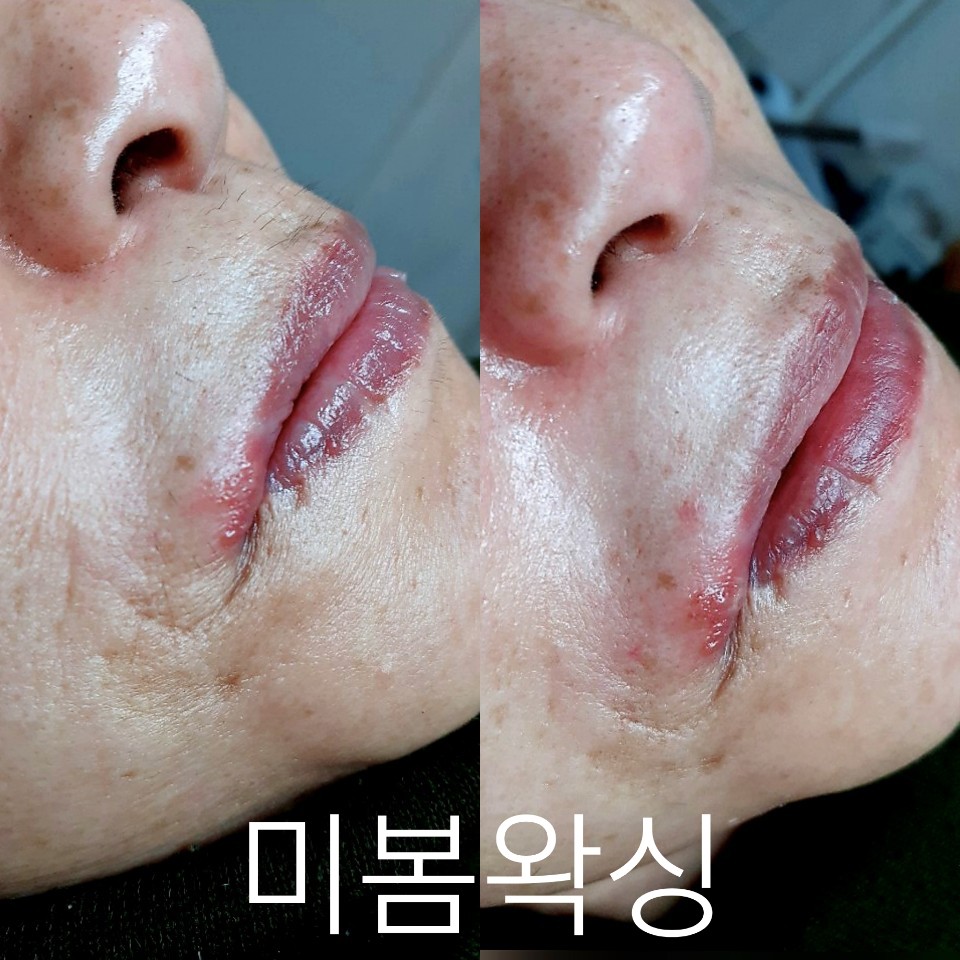 캠페인 썸네일