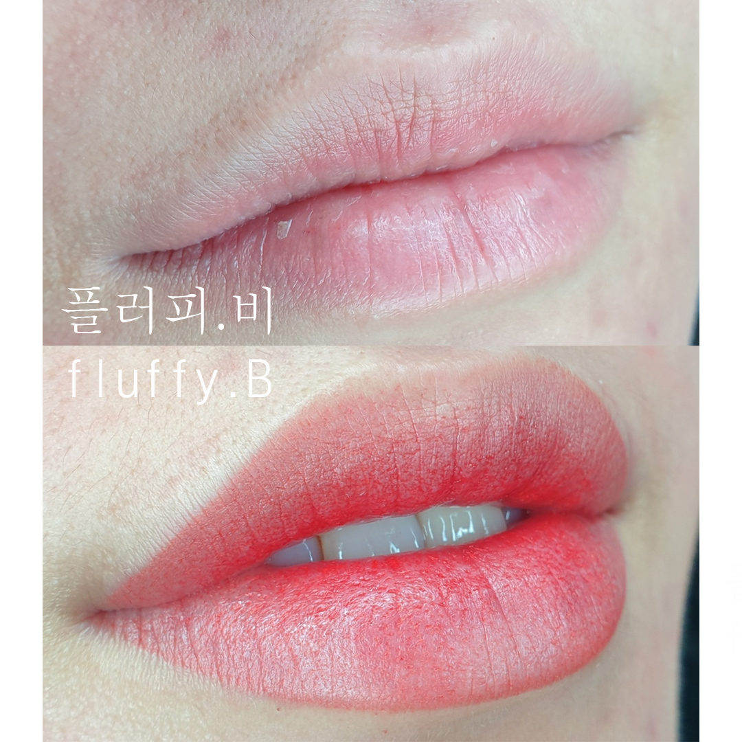 캠페인 썸네일