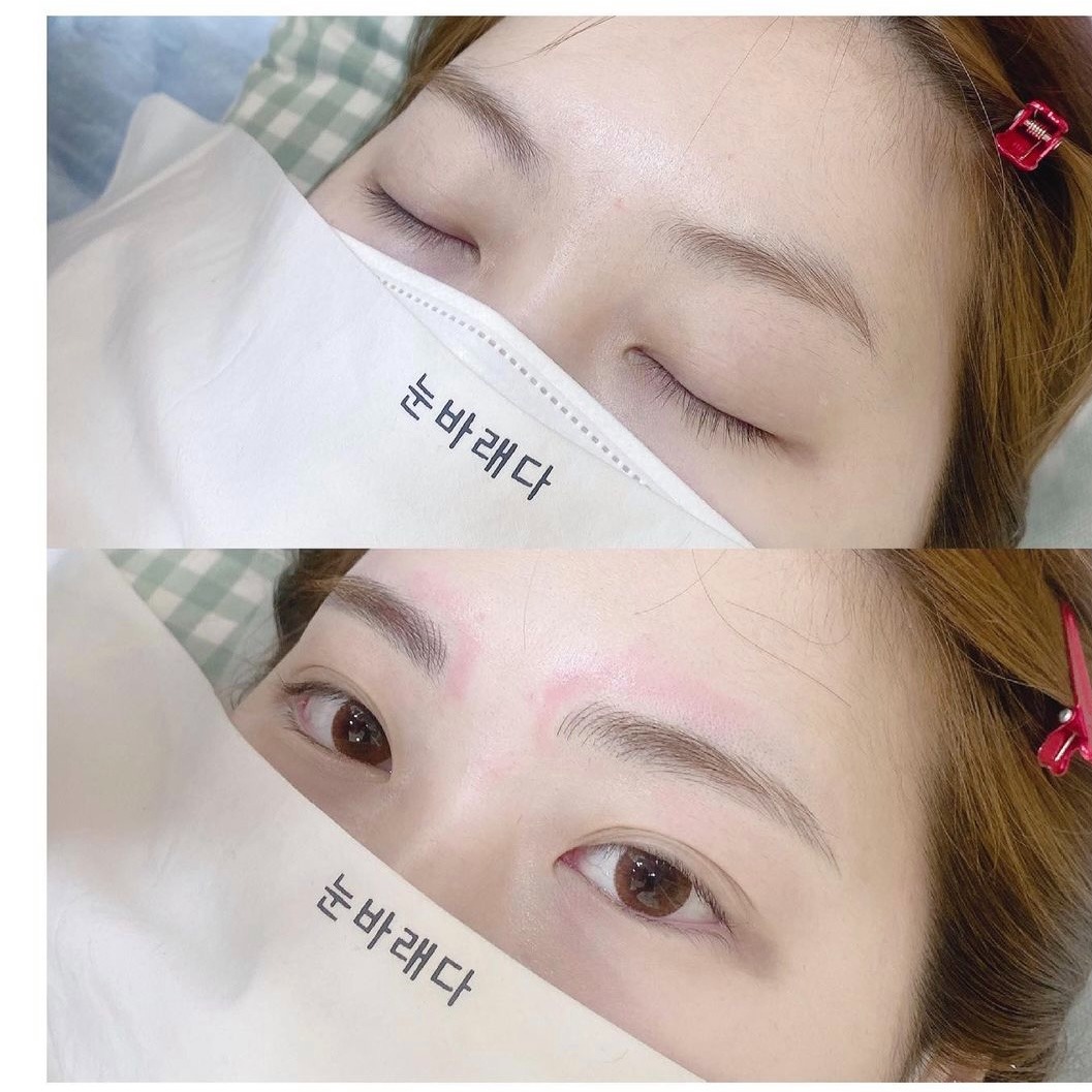 캠페인 썸네일