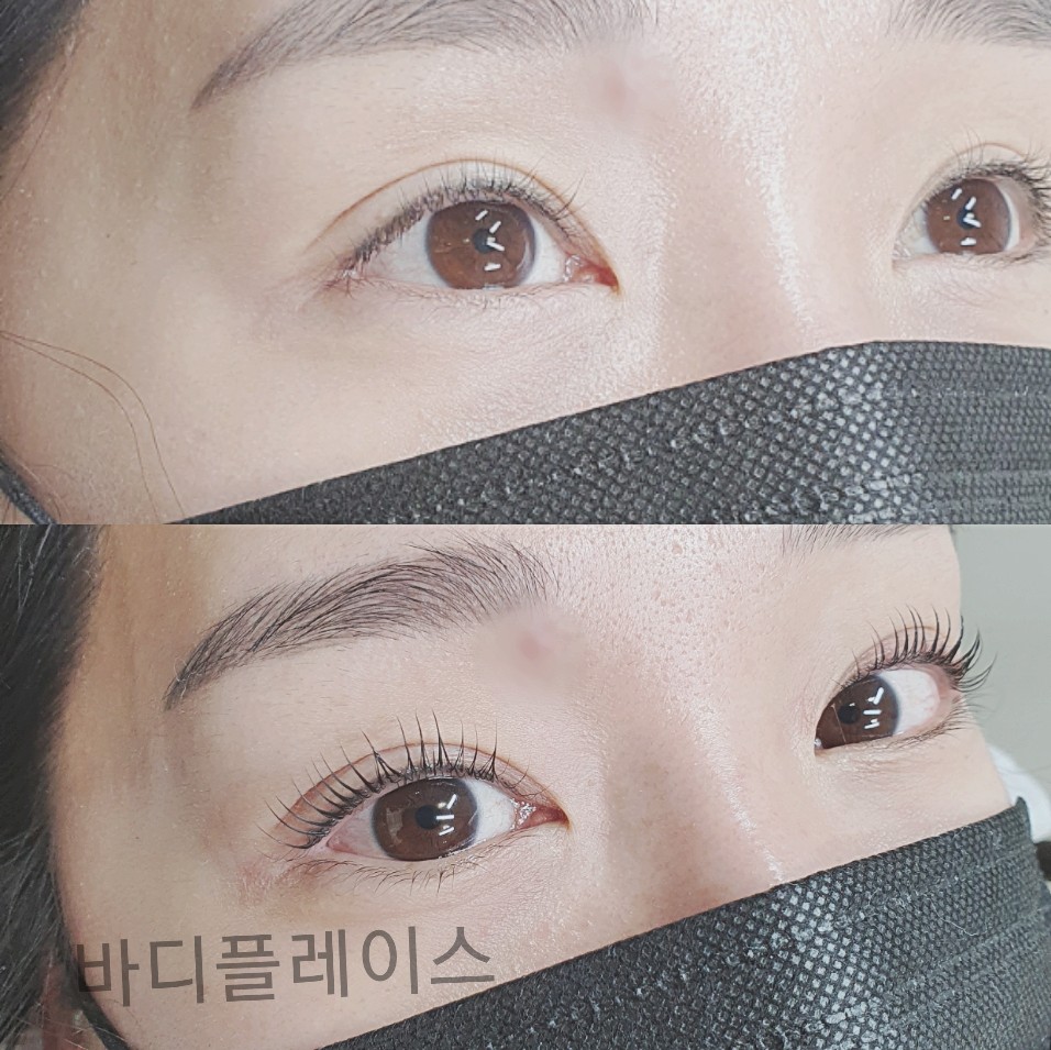캠페인 썸네일