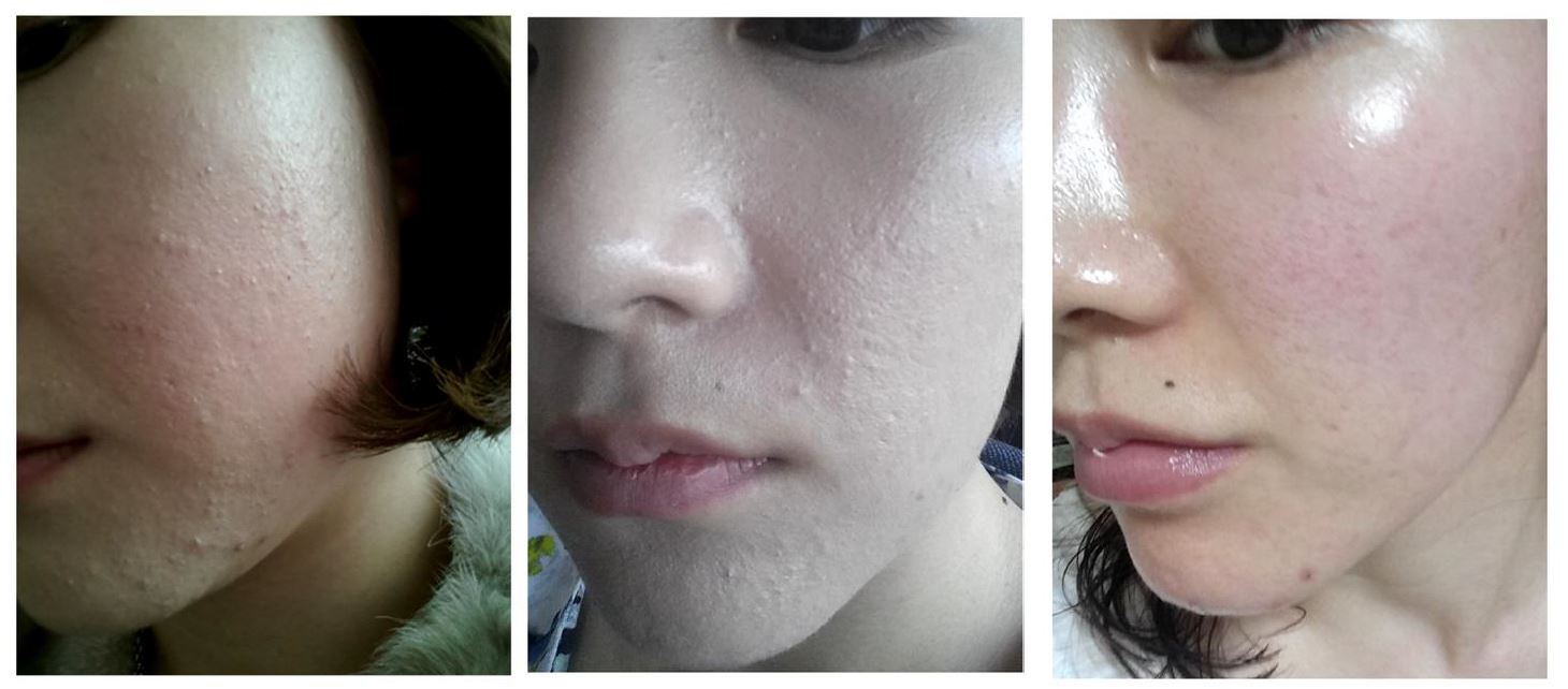 캠페인 썸네일