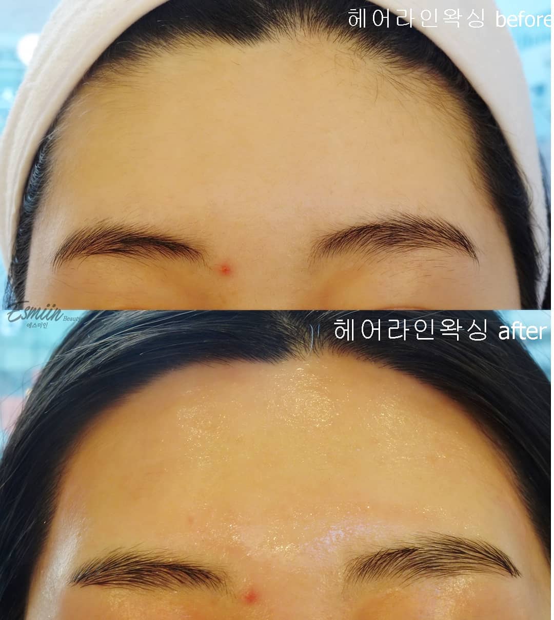 캠페인 썸네일