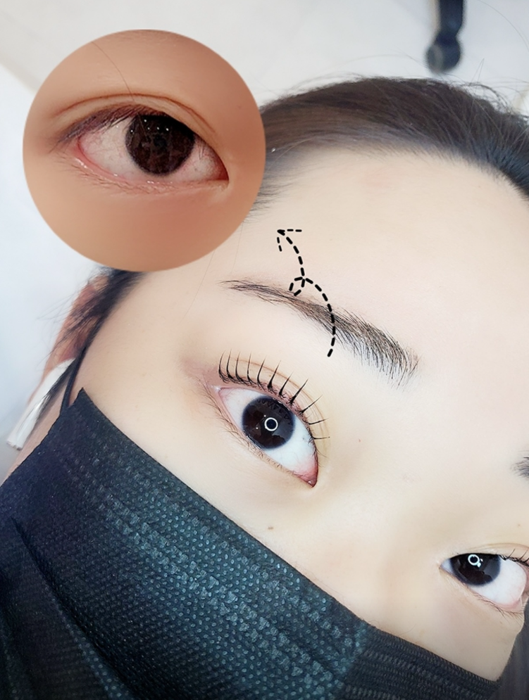캠페인 썸네일
