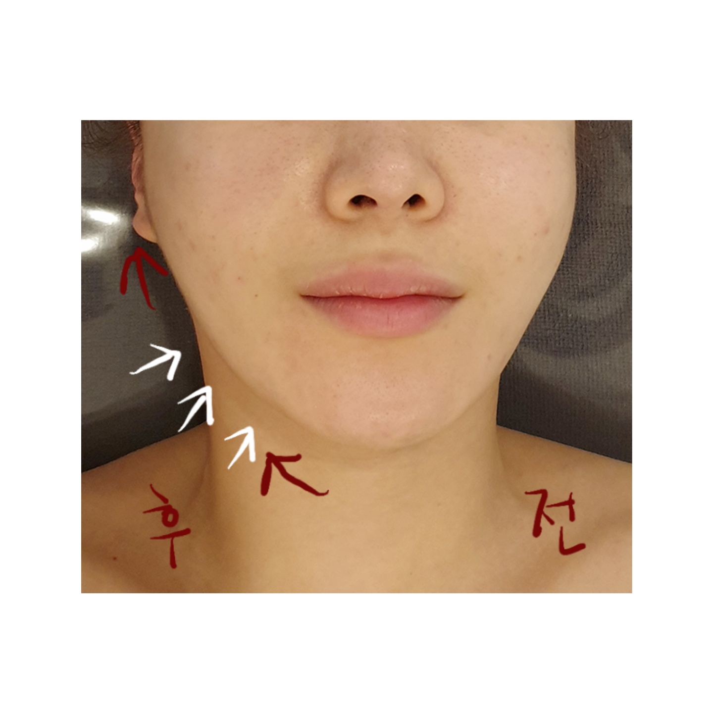 캠페인 썸네일