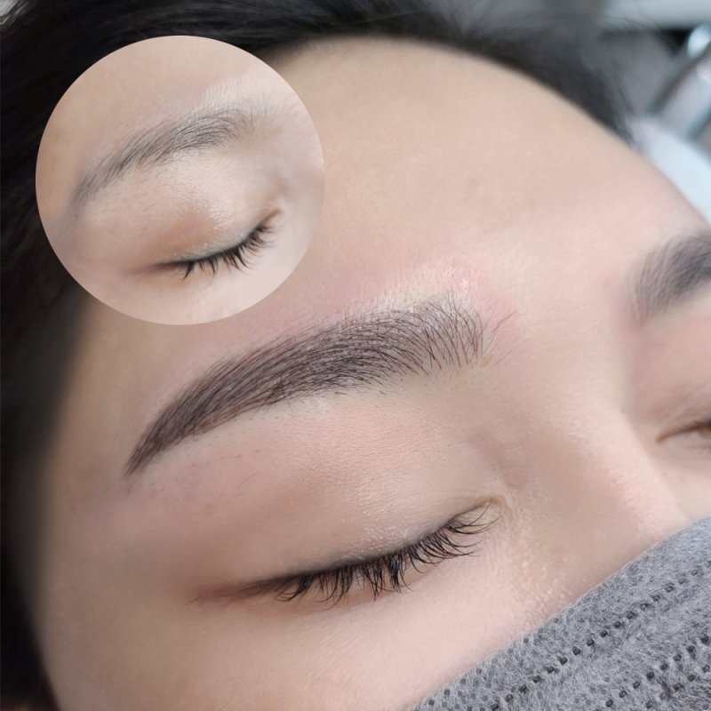 캠페인 썸네일
