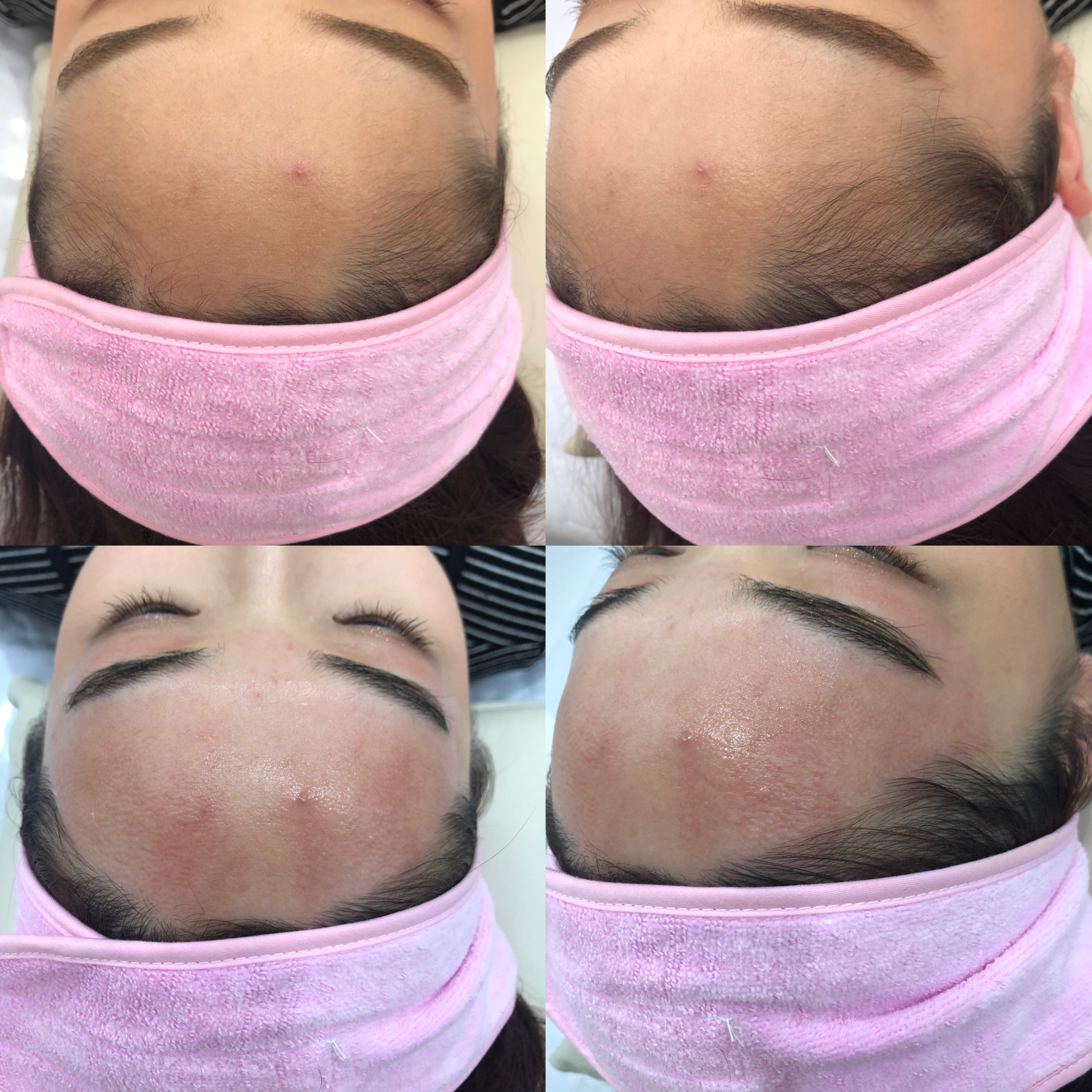 캠페인 썸네일