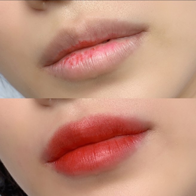 캠페인 썸네일