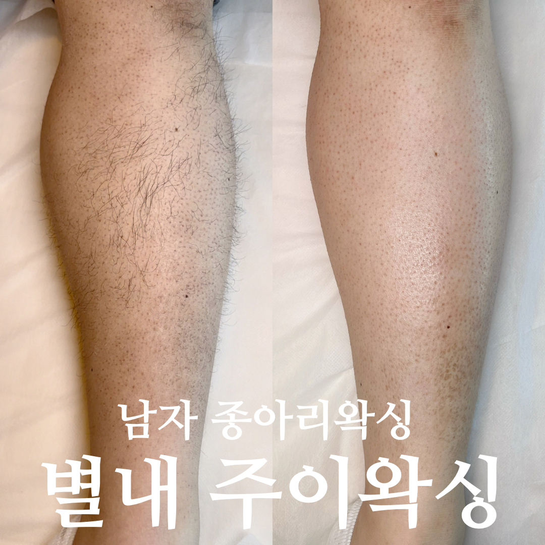 캠페인 썸네일