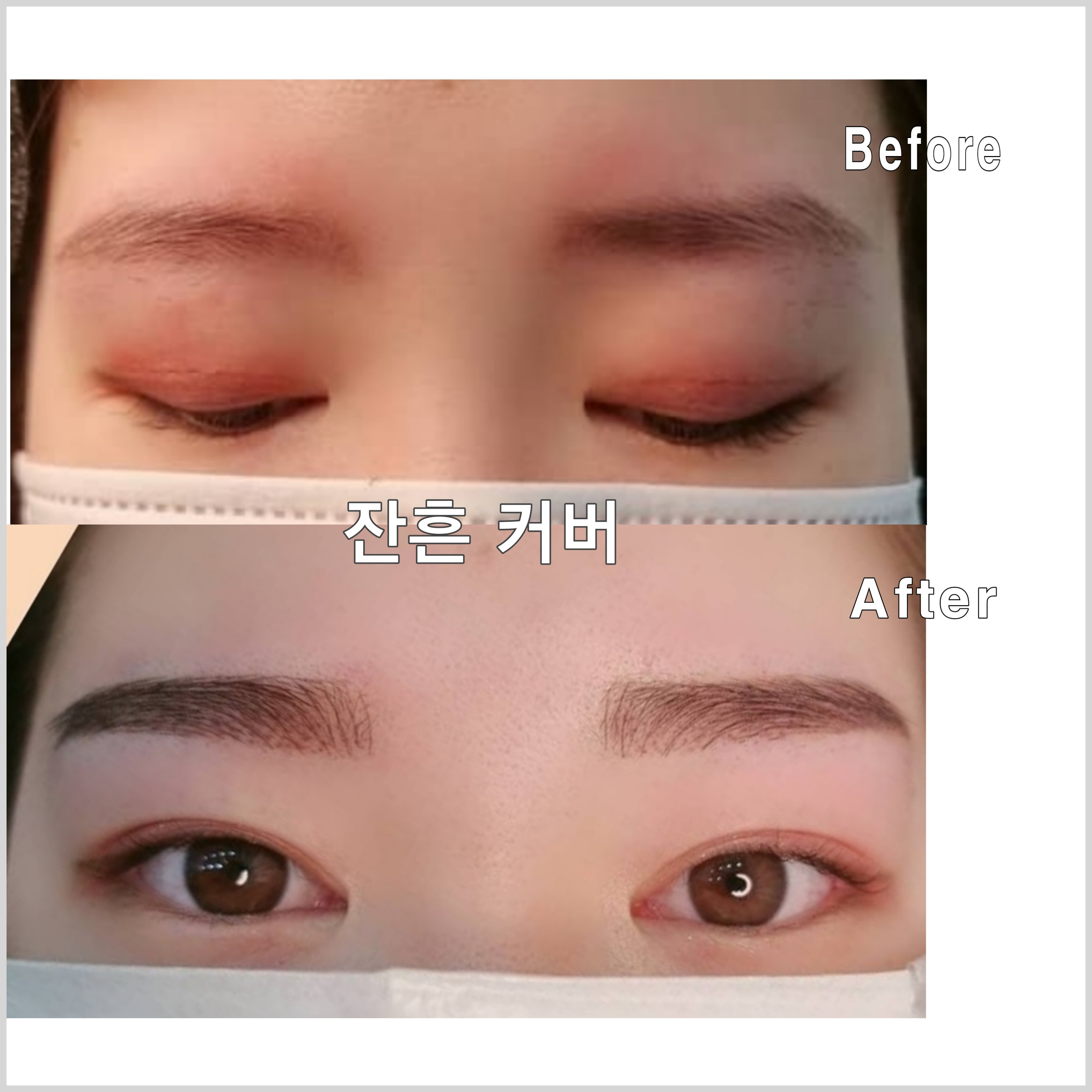 캠페인 썸네일