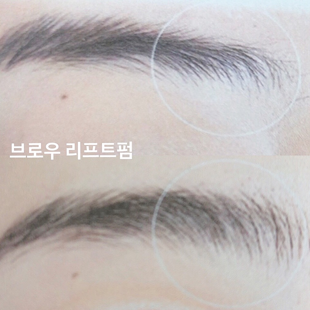 캠페인 썸네일