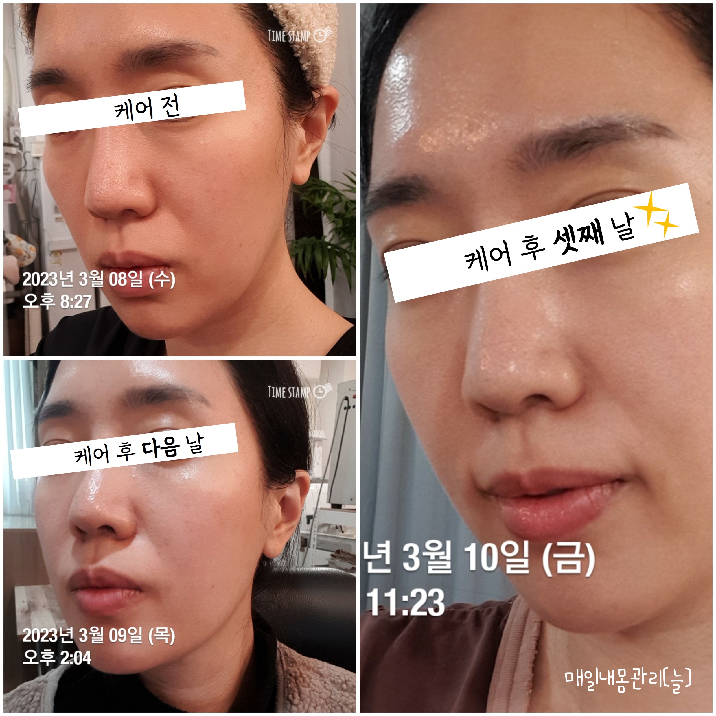 캠페인 썸네일