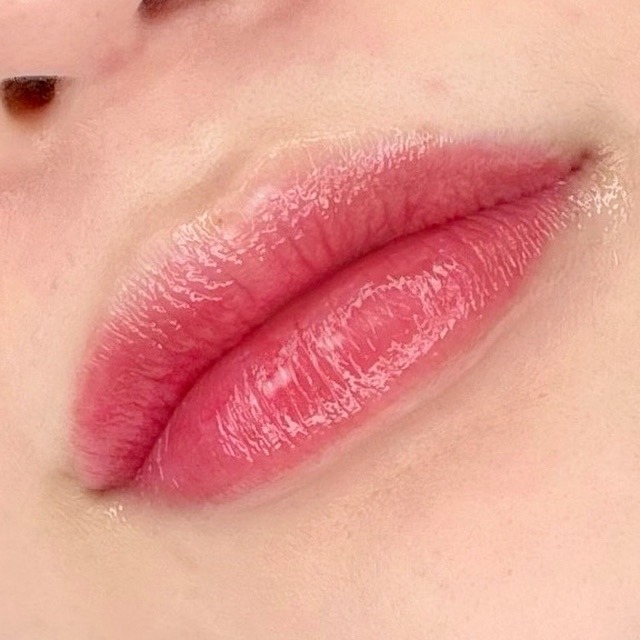 캠페인 썸네일