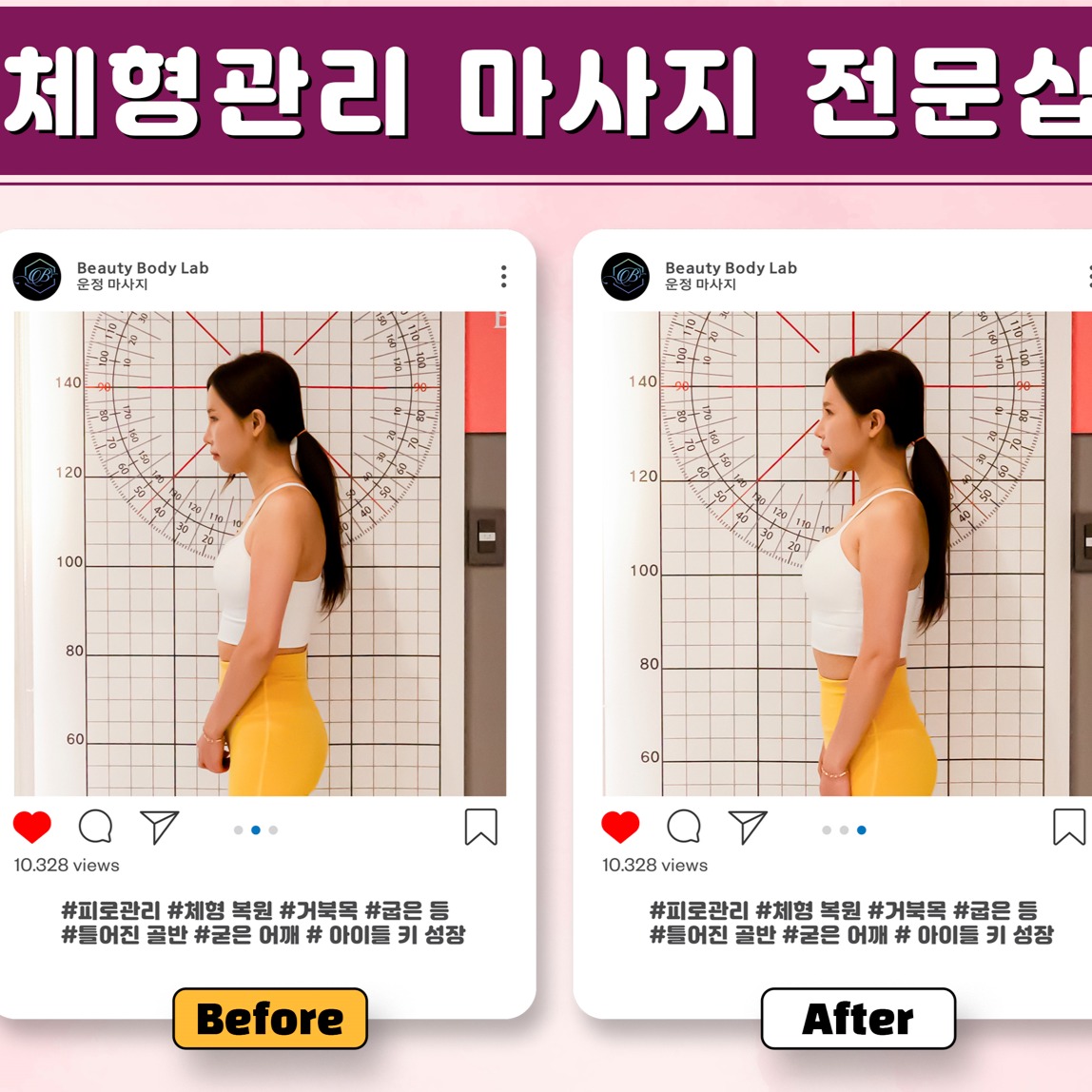 캠페인 썸네일