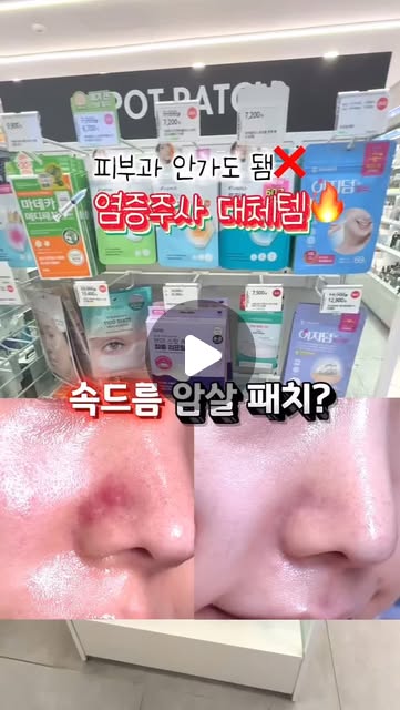 트러블 염증주사 대체템🔥 피부과 갈 필요 없어❌
속드름까지 8시간 안에 진정시켜주는~ 속드름 패치의 정석!
💚대웅제약 이지덤 뷰티 퀵카밍 패치 @easyderm.official
(8매+응급앰플+핀셋 구성)
짜지지도 않고 땅땅한 속드름..
아프기만한 속드름 다들 경험한 적 있죠?🥵
원래는 트러블 나면 곪을 때까지 기다리거나
피부과 가서 염증주사 맞고 짜고 관리하기 너무 불편했거든요ㅜㅜ
피부과 시술 대체템으로 너무 추천하는!!
자는동안 간편 케어 가능한 암살패치✨
이제 기다리지말고 바로 붙이면 돼요👍🏻
마그네슘 마이크로샷이 들어가있어서
진짜 8시간 안으로 어떤 트러블도 응.급.진.정❤️🔥
⭐️사용방법
STEP1 : 부착부위를 물기나 유분기 없이 깨끗하게 건조시킵니다
STEP2: 패치 가운데 부분이 손에 닿지 않도록 필름 제거
STEP3 : 집중 케어 부위에 앰플을 올린 패치를 수직 방향으로 누르며 부착합니다.
STEP4 : 부착 2-8시간 후 제거합니다.
딱 이거 하나만 붙이고 자고 일어나면,
속드름이 부풀지도 않고 쏙 들어가서
저처럼 트러블로 고생이신 분들은 진짜 필수템이에요!
🫒올리브영 2월 오특행사
2/7(토) 단 하루동안만 34% 할인💰(14,900원 → 9,900원)
이 날 꼭 쟁여두시는거 추천드려요 !!
#대웅제약 #올리브영 #이지덤 #퀵카밍패치 #속드름패치 #여드름패치 #트러블케어 #올리브영여드름패치 #여드름패치추천 #피부관리 #스킨케어 #트러블 #염증주사 #트러블피부 #여드름 #여드름피부 #올리브영패치 #올리브영패치추천 #속드름 #트러블패치 #올리브영트러블패치 #올영추천템 #올영세일추천템 #올영세일 #오특
