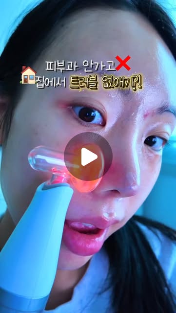 저만 이거 이제야 알았나요?🥺 트러블 때문에 피부과는 그만?❌
1000만원 쓰고 알게 된,,트러블 홈케어 디바이스🌿
리터니티 스킨힐러 플라즈마 디바이스
& 스킨힐러 캡슐 앰플 겔 @returnity_official
트러블 피부 10년차로, 피부과 시술 여러번 받아봤지만..
효과는 그때 뿐, 금새 또 올라와서 돈 아깝더라구요 ㅠㅠ
피부과 2회 비용으로, 집에서 무제한 사용이 가능한 플라즈마 기기‼️
⭐️환경이 조금만 바뀌어도 바로 뒤집어지는 본투비 여드름성 피부 맞춤
단순 클렌징으로는 제거되지 않는 모공 속 오염물질을 타겟하여 여드름균 99% 제거, 여드름성 피부의 진짜 원인을 제거해줘요!
⭐️스킨케어 부스팅 효과로 트러블 개선 효과 UP
사용 후 스킨케어 시 약물 침투 기술 원리로 흡수율을 높여줘서,
바르는 화장품의 효능을 극대화하여 피부 변화를 더 빠르게 느껴져요!
요즘 매일 꾸준히 써주고 있어서 트러블 없는 깨끗한 피부 유지중✌🏻
전 3일차까지는 효과를 잘 몰랐는데, 5일차 되니까 확실히 느껴졌어요!
트러블로 고민이신 분들 더이상 피부과에 돈, 시간 후회하지 말고
이거 꼭 써보세요 :)
#리터니티 #뷰티디바이스 #피부과시술 #트러블피부 #트러블 #트러블관리 #트러블케어 #트러블압출 #피부과추천시술 #플라즈마 #홈케어 #뷰티디바이스추천 #피부과시술추천 #여드름피부