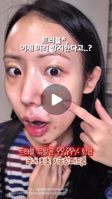 #광고 @fation_official
💚파티온 노스카나인 트러블 패드
전문 피부제로 유명한 동아제약의 연구진들이 만든
국내 최초 여드름성 피부 완화 기능성 패드‼️
예전부터 트러블* 달고 사는 트러블 10년차 피부인데요..🙋🏻♀️
이마, 턱, 코 옆에 작고 큰 트러블들이 꾸준하게 올라오는데
이럴 때 집에서 트러블 케어하는게 정말 어려웠어요ㅠㅠ
이제는 이 패드 단 한장으로! 피부 전체 케어 가능해요✌🏻
무려 트러블 유발하는 아크네균 99.99% 항균**효과로,
트러블이 더 이상 올라오지 않는 피부 컨디션 만들어줘요!
2분할 패드로 이마, 턱, 코 옆 좁은 부위의 트러블 집중케어까쥐🥺
저처럼 민감한 트러블 피부도 자극없는 저자극 포뮬러라서,
예민하고 따가울 걱정은 NO❌
단 10분, 이 패드 한장으로✨
피부 어떤 부위에 어떤 트러블도
트러블 생기기 전부터
사전 케어는 물론 진정까지 가능하니까
저같은 트러블 피부들은
집에 꼭 쟁여놓으세요👍🏻
*민감,자극,건조,거칠어짐 등의 피부 트러블에 한함
**항균력에 대한 인체 대상 항균 시험 (시험균주:아크네균)/한국피부과학연구원/2024.12.12/21명/개인차있음
#파티온 #트러블패드 #파티온트러블패드 #트러블관리 #트러블피부 #트러블케어 #트러블 #여드름피부 #여드름 #여드름관리 #스킨패드추천 #스킨케어추천 #기초케어 #스킨패드 #민감성피부 #스킨케어 #동아제약 #제약회사화장품 #제약회사 #색소침착 #화농성트러블 #트러블진정 #여드름진정 #코덕