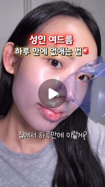 피부과❌ 성인여드름 하루만에 없애기?
아픈 속드름부터 짜기 힘든 트러블까지,
하루 만에 초고속 진정시키는 여드름 피부 전용 마스크팩🌿
💙프롬메디 아줄렌 시카 카밍 마스크💙@frommedi_official
저는 중학생때부터 트러블, 여드름으로 고생했었고
지금도 성인 여드름으로 매주 피부과 다녀도 그때 뿐이더라구요ㅠ
여드름성 전용 마스크팩이라해서 바로 써봤는데,
딱 이 제품으로만 홈케어 해줬더니 진짜 트러블 피부 탈출했어요🥹🔥
99% 고순도 아줄렌 + 시카 함유(차세대 트러블 케어 성분)가 듬뿍 들어간
진정 앰플 한 병 효과의 팩이 피부 속 10층까지 케어해줘서
아픈 속드름부터 짜기 힘든 트러블까지 진짜 효과 대박이에요..👍🏻
여드름 피부 사용 적합 테스트 완료로 자극? 걱정 노노❌
붙이자마자 피부 온도 낮춰주는 쿨링 효과라서
피부 자체가 트러블 안나는 환경으로 만들어지는거 있죠!!
🫒올리브영 3월 세일
이번 올영세일 때 저렴하게 구매가능하니까
트러블 고민이신분들 꼭 쟁여두시는거 추천드려요❤️🔥
#프롬메디 #아줄렌팩 #여드름 #트러블 #올영추천템
