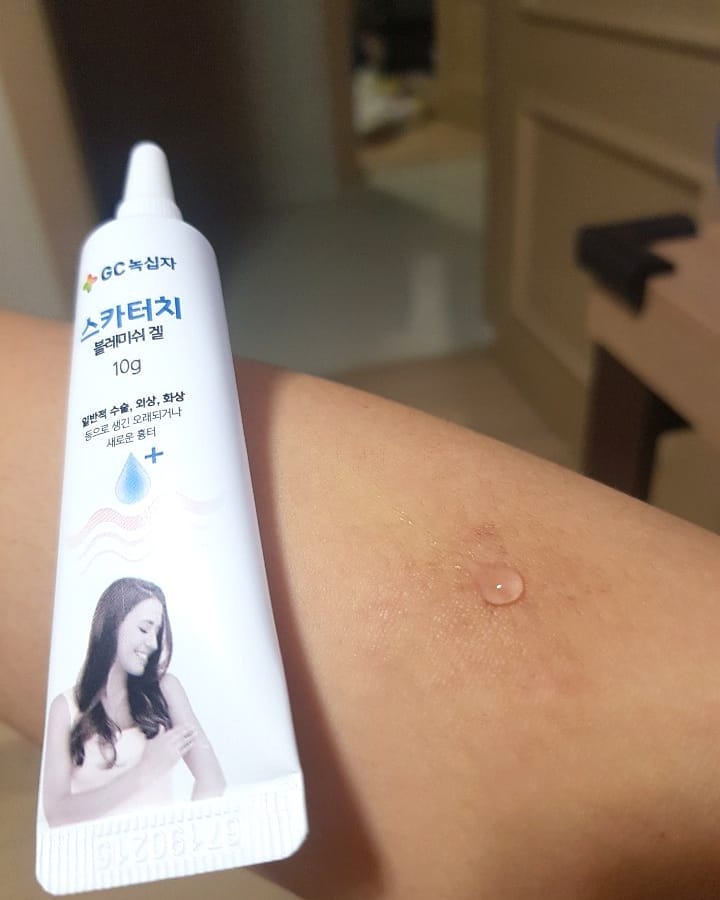 아이엠로로🌸 on Instagram: “오래된 흉터까지도 관리해준다고? 말도 안된다고 생각햇지만 말이되버리기..👍👍👍 아직 사용한지 한달 못되었지만 부지런하게 쓰면 정말 큰 효과도 볼수있을 것 같다 방수도되고 통기성도 넘나좋은것❤❤❤❤ 몸땡이 흉터 왜케많아서.. 저건 넘 작다 대용량…”