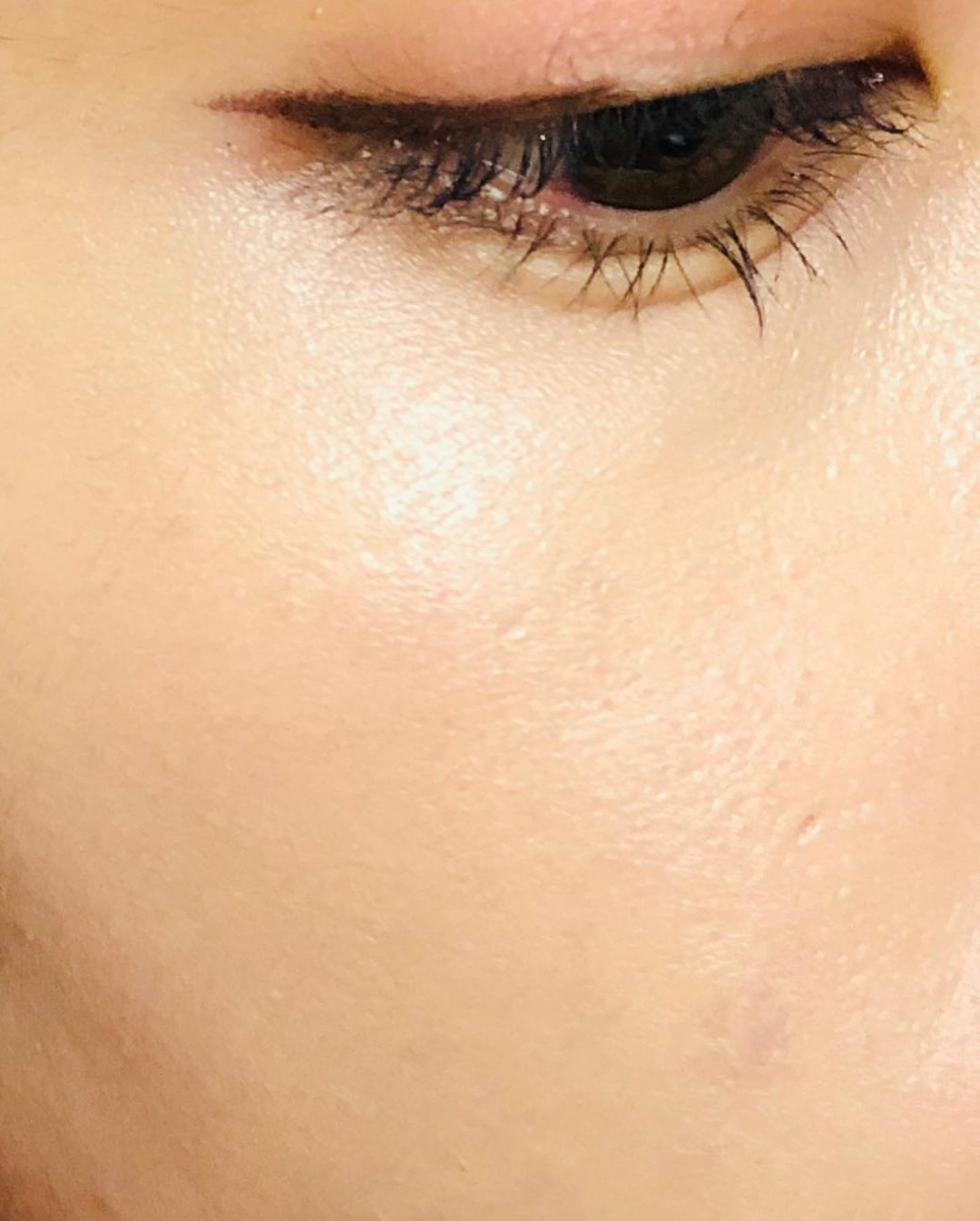 Humya on Instagram: “트러블+흉터가 득실한 볼과 턱은 그동안 커버를 포기했는데, 트러블 피부에도 사용하기 좋고 얇고 넓게 커버하기 좋은 컨실러에요 :) 울퉁불퉁한 피부지만 잘 바를 수 있어요!  #로하셀 #로하셀컨실러 #lohacell #로하셀리얼피팅컨실러…”