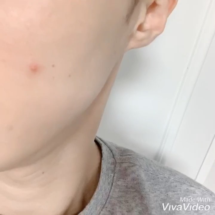 화장품대통령 Cosmetics president on Instagram: “커버력높은 남성에어쿠션  요즘에 트러블 안나다가 나서 급하게 외출 할때 간단하게 바르기에 딱 좋은 포맨트 에어쿠션 가져왓어요~  에어쿠션은 커버력이 낮아서 그럴거면 맨얼굴에 다니자 주의자엿는데 이번에 마음이 바뀌었네요 커버력이 높아서 코옆 트러블 볼…”