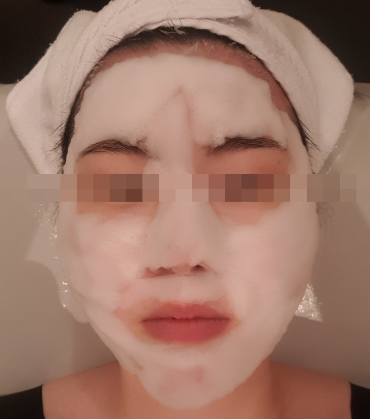 홍대 셀트리온스킨큐어에서 여드름치료와 수분충전하고왔어요
