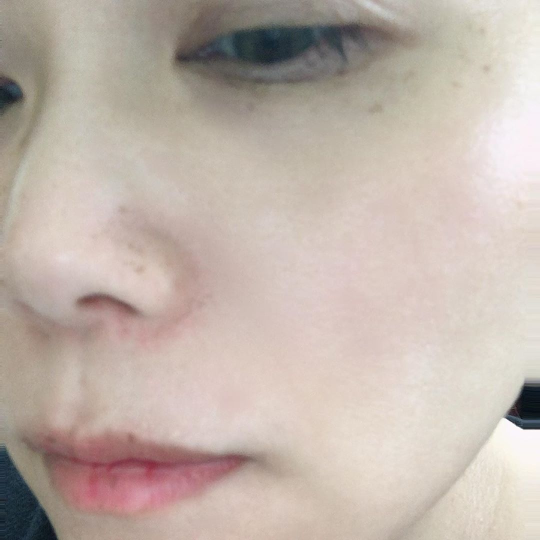 Hee Young Juliet Kim on Instagram: “환절기만 되면 갈라지고 당기는 내 얼굴!! 드디어 내 얼굴의 수분을 채워줄 제품을 만났어요!!! 메치니코프가 최초로 발견한 장수유산균 함유한 나의 토너!!!! 유