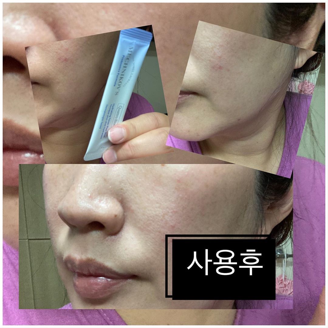 @jiyoung1040 shared a photo on Instagram: “#광고 #메치니코프 #메치니코프토너#피부만수무강하세요 #탄탄보습 #환절기토너추천 #보습토너추천#협찬 유산균이 좋다는거 다들 아시죠 아침저녁으로 날