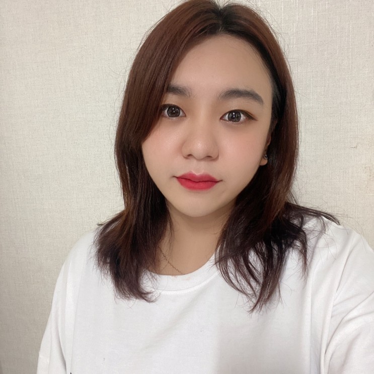 교대피부과 코조각주사 2차 후기!