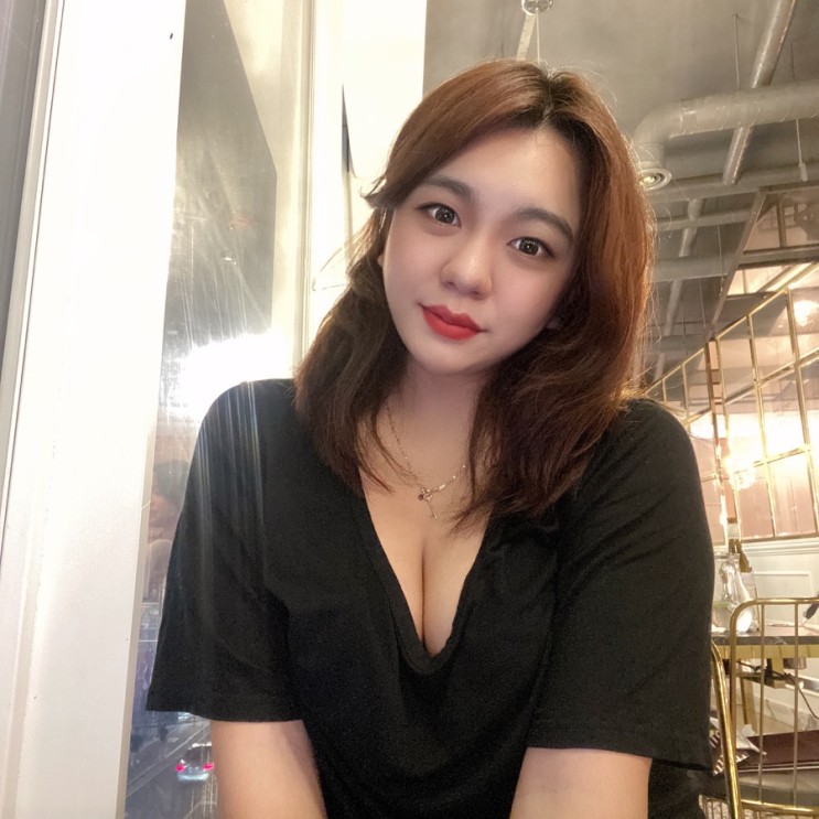 강남 신사역 성형외과 얼굴지방흡입 2달차 바이오본드 관리 및 후기