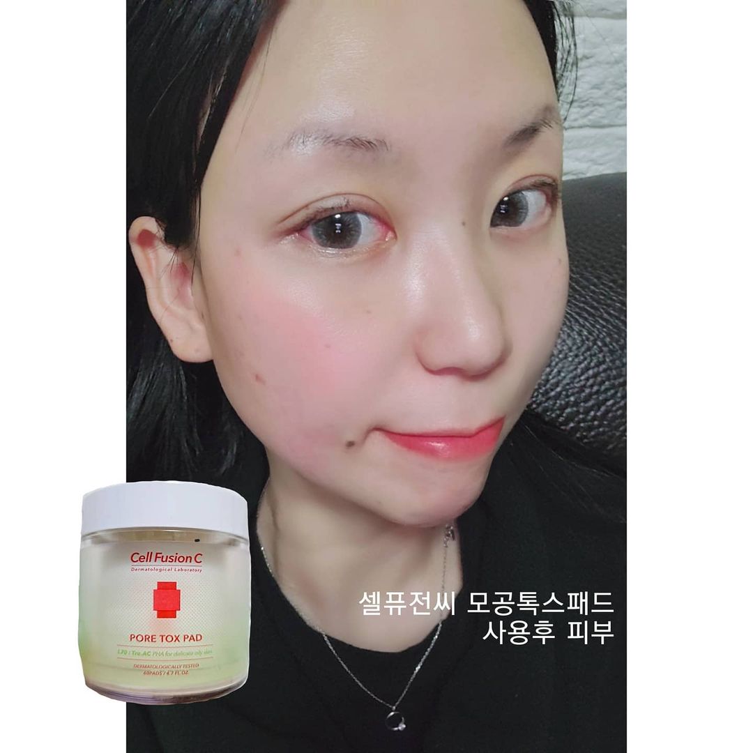  “#제품제공 #인스타리뷰의무없음 ❣이번 리뷰해볼 제품은 #셀퓨전씨 #모공톡스패드 입니다❣ ღ발림성&제형: 우선 제형은 너무 물제형도 아닌 되직한 제형도 아닌 평소 세럼 정도의 농도의 에센스가 흡수되어있어요!❕💧 패드 자체가 모공패드여서 그런지…”