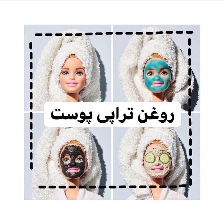 سلام دخترا
به مدت نبودیم از امروز دوباره قوی شروع میکنیم😍
اول از همه پست رو سیو کن گمش نکنی و برای دوستات بفرست❤️
امروز راجب روغن‌تراپی پوست قراره بهتون توضیح بدم 
پس خوب کپشنو مطالعه کنید😁💕

روغن تراپی پوست با روغن‌های گیاهی خیلی وقته که در خیلی از نقاط جهان انجام میشه چون استفاده از روغن‌های گیاهی که از دل طبیعت استخراج شده‌اند، تاثیر بیشتری از داروهای شیمیایی داره.

🌿دو نوع مشکلات پوستی داریم: یکی مشکلاتی هست که در اثر عملکرد نامناسب پوست نسبت به محیط و شرایط دیگه به وجود میاد و نوع دیگه مشکلات پوستی مربوط به عدم عملکرد مناسب اندام‌های داخلی و کمبود بعضی از ویتامین‌هاست. با روغن تراپی نمیشه مشکلات ریشه‌ای رو از بین برد و نیاز هست اول با مراجعه به پزشک متخصص مشکل داخلی رو برطرف کرد.

🌿باید بدونیم که شیوه روغن تراپی پوست برای هر فردی با فرد دیگه فرق داره و باید پیش از روغن تراپی، از کارشناسان این حوزه مشاوره گرفت تا روغن‌‌های مناسب پوست شما رو با روش‌های مصرف خاصی که دارن برای شما تجویز کنن.

🌿باید صبر و حوصله کافی داشته باشین و روغن تراپی رو به طور مرتب در زمان‌های تعیین شده انجام بدین تا به نتیجه دلخواهتون برسین.

🌿فواید روغن ترا‌پی پوست:
1. باعث درمان چروک‌های پوستی میشه
2. از خشکی پوست پیشگیری میکنه
3. باعث کاهش التهاب‌های پوستی میشه
4. با کمک روغن‌های گیاهی می‌توان لایه‌برداری پوست رو انجام داد
5. با بعضی از روغن‌های گیاهی میشه لک‌های عمقی رو از بین برد
6. با کمک روغن تراپی پوست، بافت پوست نرم‌تر شده و لایه‌های پوستی تغذیه میشه
7. باعث از بین رفتن جوش و آکنه میشه
8. باعث از بین رفتن سیاهی دور چشم میشه
9. باعث از بین رفتن ترک‌های ناشی از بارداری و افزایش وزن ناگهانی میشه
10. خارش پوستی درمان میشه

خب دخترا پس دیدیم که روغن تراپی کلا خیلی خوبه و فایده‌های زیادی داره چه برای مو چه برای پوست🙌🏻

اینم بگم که هر روغنی که نیاز داشته باشید از طریق خود ما میتونید تهیه کنید🥰

#راپونزل #راپونزل👸 #روغن_تراپی #روغن_تراپی_پوست #روغن_آرگان #روغن_نارگیل #مراقبت_پوست #مراقبت #مراقبت_از_پوست