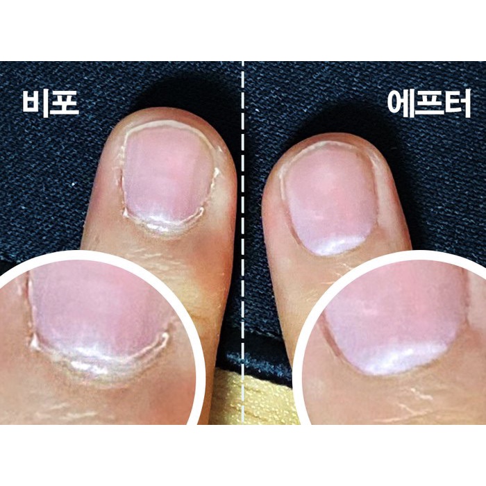 올영추천템 세라믹 포켓 루즈스킨 리무버로 큐티클 조져봄!