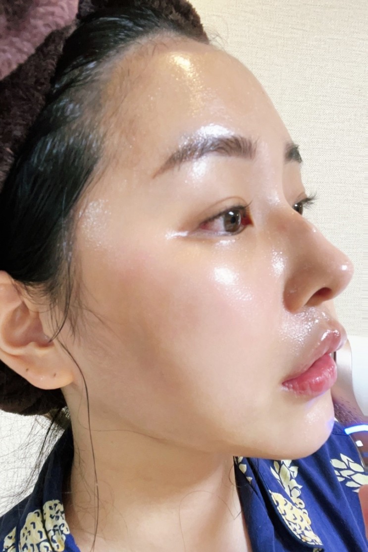 [30대중반 피부관리 루틴] 디바이스 홈케어 관리팁 (with 리바에스 냉온 초음파 갈바닉 마사지기)