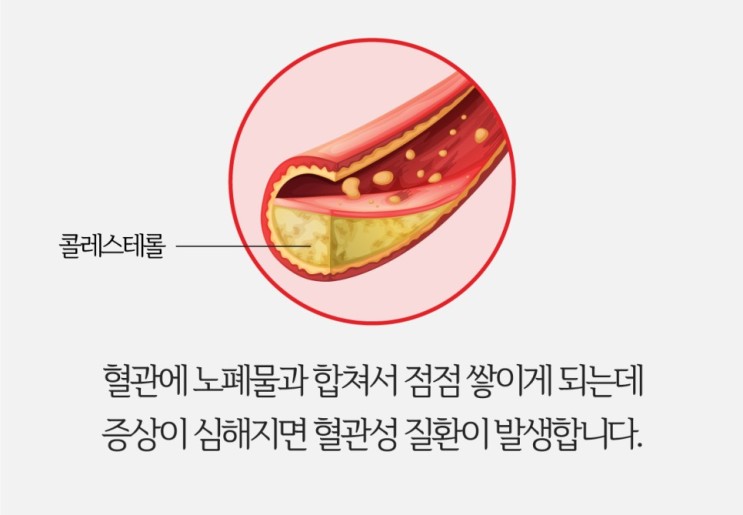 콜레스테롤 낮추기 대마종자유,대마종자유오일