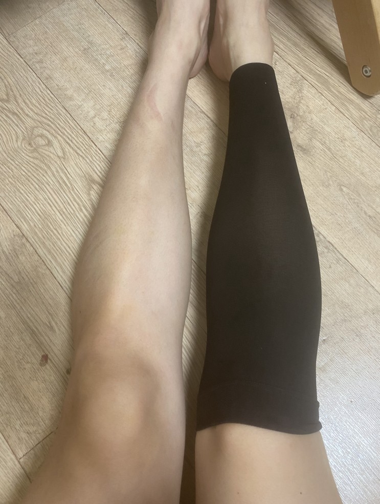 압박스타킹 어떻게 골라신어야할까? 바디윌 압박스타킹 [올바른압박스타킹착용법]