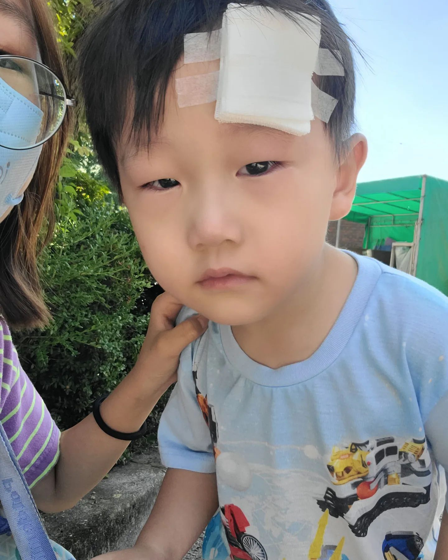 울어서 눈이 부은 우리 둘째네요...
보고 있자니 너무 안쓰러워서..
오늘 집에서 와 다다다다 뛰다가 이마 1cm 이상..
어휴~
봉합수술하고 왔어요..
주차장이 너무 더워서 차에 시동 걸고 에어컨으로 차 시원하게 돌리는 동안 더워서 나무그늘에 있으라고 했거니 누나랑 나무그늘에서 사진 찍었더라고요.
아프고 많이 놀란 둘째...
둘째 상처와 피를 보고 놀라서 울던 첫째..
놀란 가슴 쓸어내리고 평정심을 찾아 두 아이들 진정시키고..
탈지면으로 상처 부위 눌러주면서 지혈시키고...
멸균거즈에 종이 반창고로 급하게 상처 부위 처치해서 서울대학교병원 아동 응급실로 운전해서 가는 20분이 참 길게 느껴졌던 하루였습니다.
상처 부위가 깊어서 혹시 근육 손상까지 되었을까 걱정했는데...
다행히도 성형외과 주치의 선생님이 보시더니 근육은 안 다쳤다고 말씀해 주시는데 안도의 숨을 쉬었어요.
근육을 다치면 근육 봉합까지 했어야 하는 상황인지라 정말 다행이다 싶었어요.
아직 어리고 병원을 극도로 무서워하는 둘째는 어쩔 수 없이 수면마취를 하고 봉합수술을 했어요.
마취에서 깨어나서 구토 증상으로 토를 하기는 했지만 그 이후로는 이상 없이 잘 놀고 잘 먹고 있네요.
계속 지켜보면서 이상이 없길 바라고 바라보면서...
저도 육퇴를 해보려 해요.