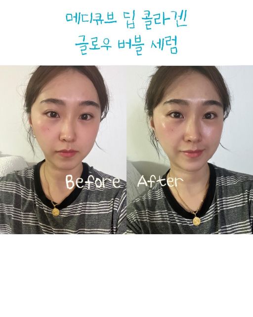 깜미 on Instagram: "#광고 숨어있는 잃어버린 얼굴 광채 찾고싶은 사람 집중해주세요🫶🏻 단 1회 사용으로도 집에서 물광 리프팅 관리가 되는 메디큐브 딥 콜라겐 글로우 버블 세럼입니다🫣