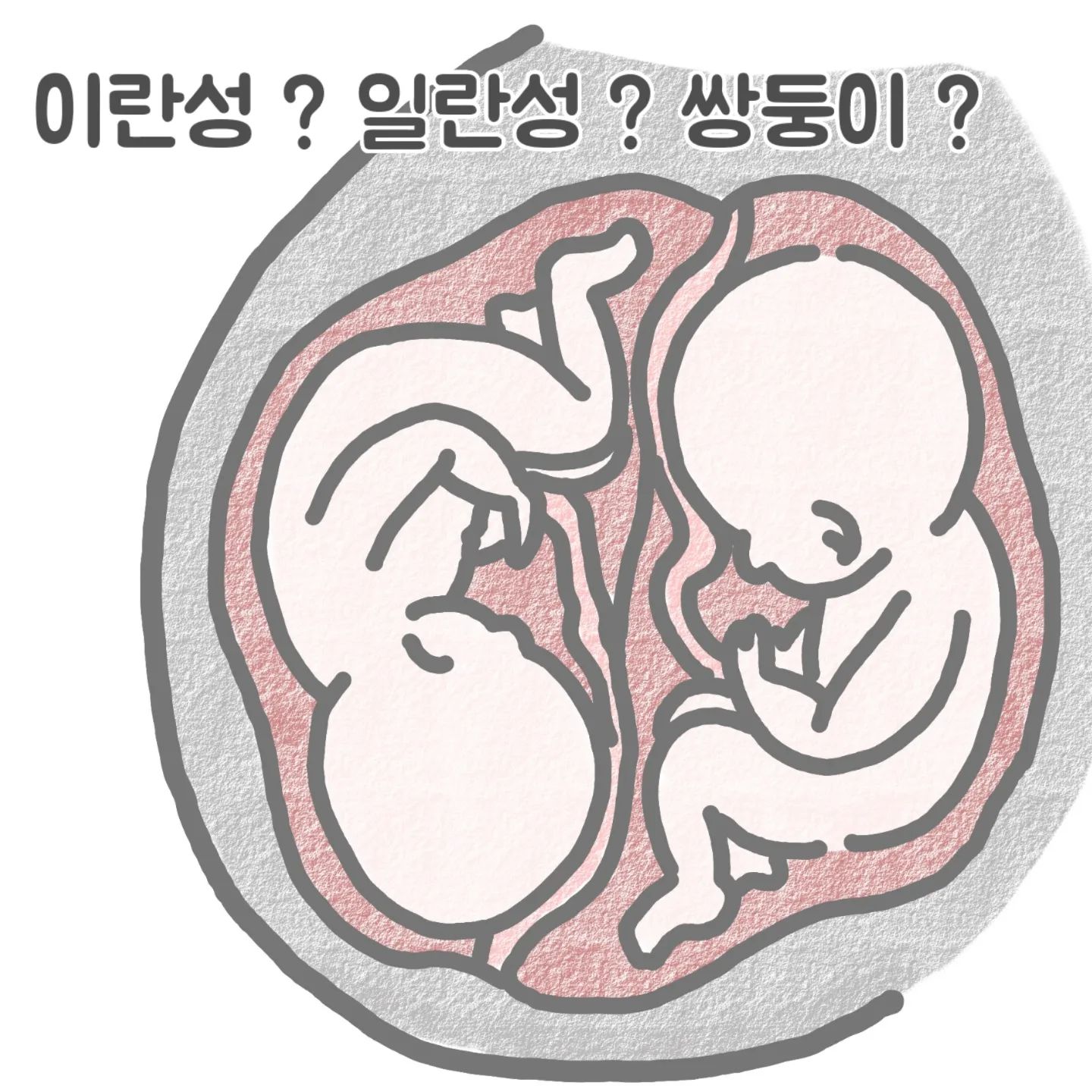 생각보다 쌍둥이를 많이 어려워 하시는
분들이 많으시더 라구요 ㅎ
이미 아이들을 다 키우시고 어른이 되신
어르신들 어머님들 심지어 저희 엄마까지🤣
이 툰을 보고 그나마 조금 도움이 되셨으면..아니 오히려 좀더 어려우셨으려나..🥲🥲🥲 ㅎㅎㅎ 날씨가 추워지려다가 갑자기 다시 따뜻해 진거같아요 ㅎ 그런데 요즘 하늘은 정말 맑아요! 그런데 주변 아이들이 수족구에 바이러스에 감기에 구내염에..정말 안아픈 곳이 없는거 같아요..저희 둥이들도 어제부터 감기를 달고 살고있어요 🥲 어린이집을 안다녀도 잠시 접촉만 해도 정말 아이들은 금방 옮아버리네요.. 오늘도 피곤한 하루를 보낼 엄마들 잠시의 휴식은 코맹툰과 함께 오늘도 힘내세요 화이팅❤
.
.

#쌍둥이수면교육 #육아툰#쥐띠맘#쌍둥이재우기#생활툰#쌍둥이재우기스킬#유아바디필로우 #유아베개추천 #육아일기#임산부툰#반려견툰#육아공감툰#남매둥이 #쌍둥이육아#육아소통#쌍둥이툰#쌍둥이#쌍둥이육아툰#신생아재우기#아기잘자는법
#통잠성공#코알라쿠션#통잠베개#신생아바디필로우#신생아바디필로우추천#아기바디필로우#육아스타그램#유아코알라쿠션