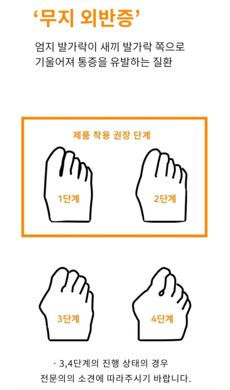 집에서도 "무지외반증" 교정이 가능한 교정기_스페셜 프로텍터스 제품 후기