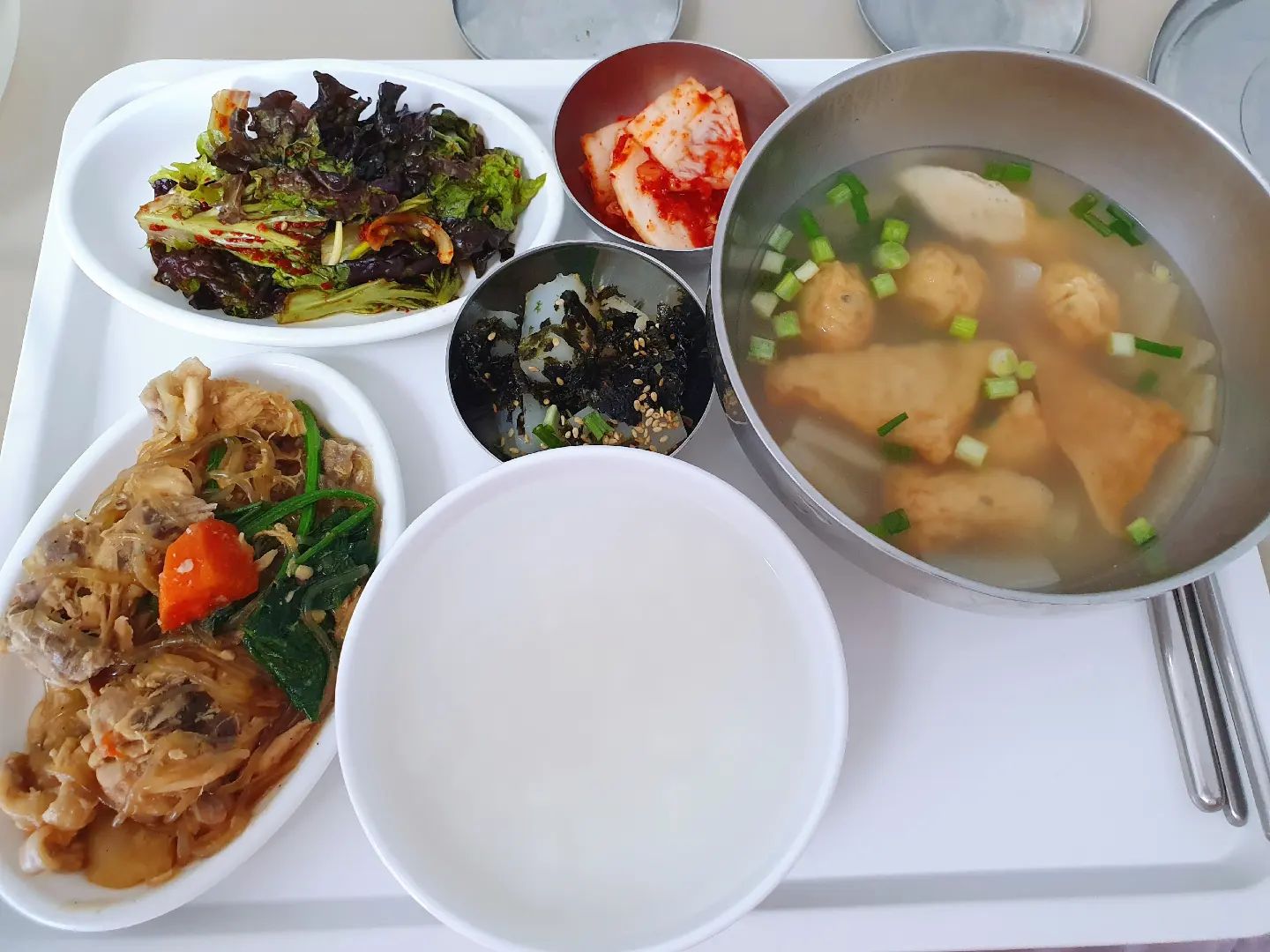 이제 병원생활도 얼마 안 남았다
나가서 어서 맛있는 거 먹고파....
이주도 안남았다구!! 야호 신난다ღ

신랑이랑 요즘 대화하면서 다시 한번 더
느끼고 있는 건 우린 서로한테 항상
고마워하고 서로가 서로를 짠하다
고생한다 말로 표현한다는게 넘 좋다❤

오늘이 딱 오빠랑 8년째인데 난 너무
즐겁고 행복하다•̀ᴗ•̀ 앞으로가 더욱더
기대되고 설레는 삶이랄까

조금만 더 화이팅하자구요 ෆ˙ᵕ˙ෆ